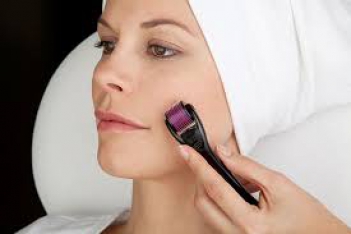 So sánh phương pháp lăn kim và phương pháp Laser - DU LỊCH HÀ TIÊN